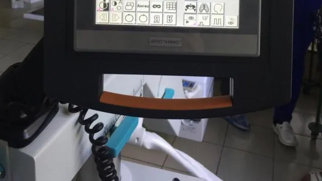 В Железноводске запустили новую рентгенохирургическую систему