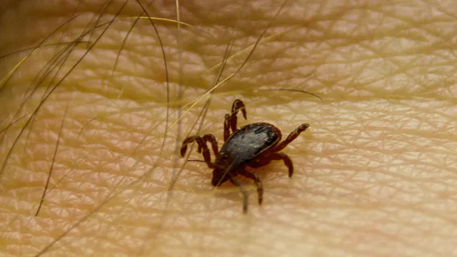 На Ставрополье уже 30 человек заразились КГЛ